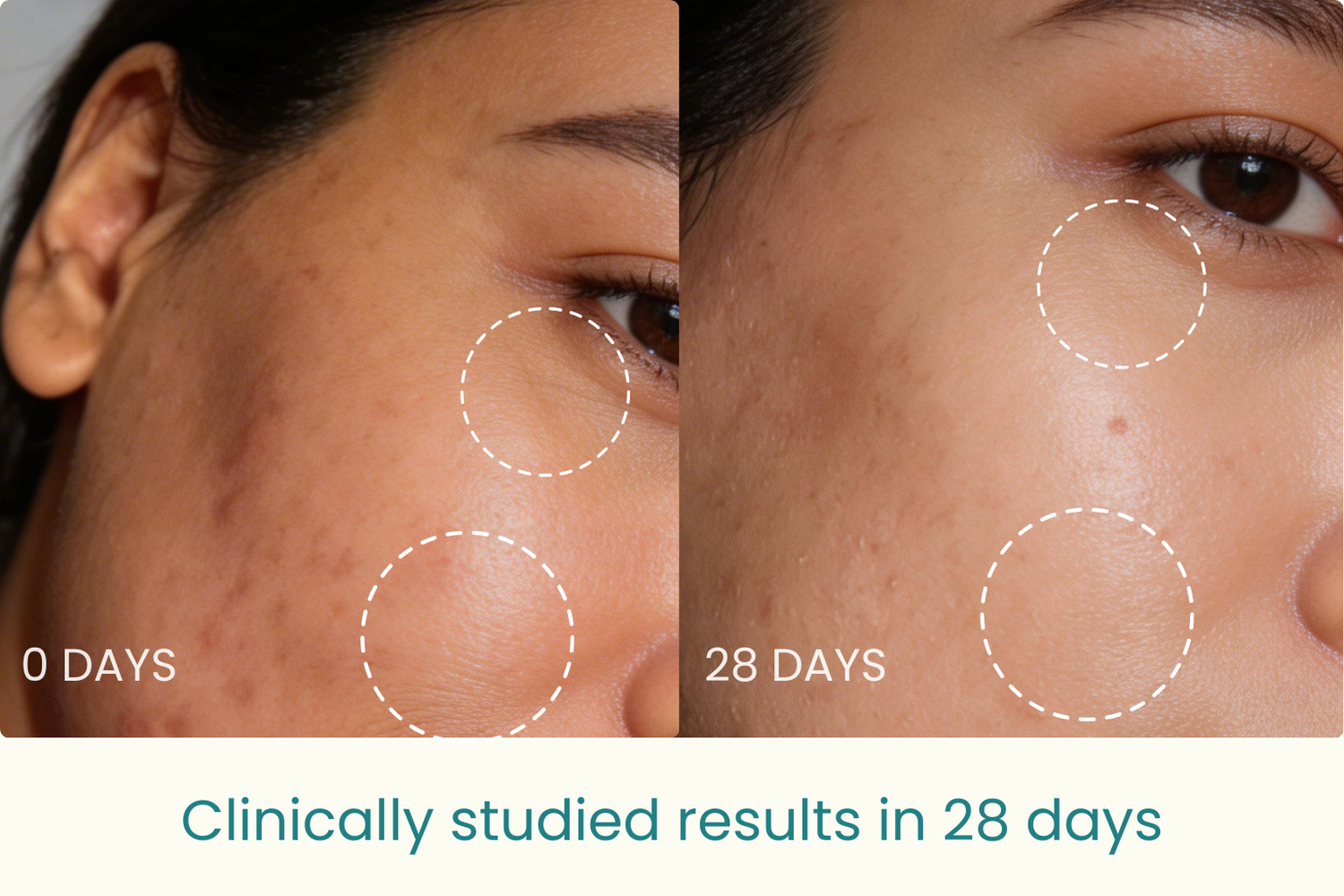 Clinically studied collagen peptides with noticeable skin improvements in 28 days. Halal-certified, grass-fed, and designed to support your daily routine. v2