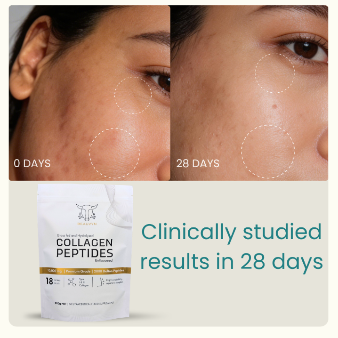Clinically studied collagen peptides with noticeable skin improvements in 28 days. Halal-certified, grass-fed, and designed to support your daily routine.